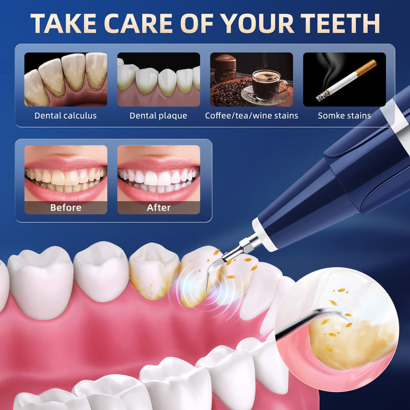 [Australia] - Plaque Remover for Teeth - Tartar Remover for Teeth, Dental Calculus Remover Teeth Cleaning Kit 
