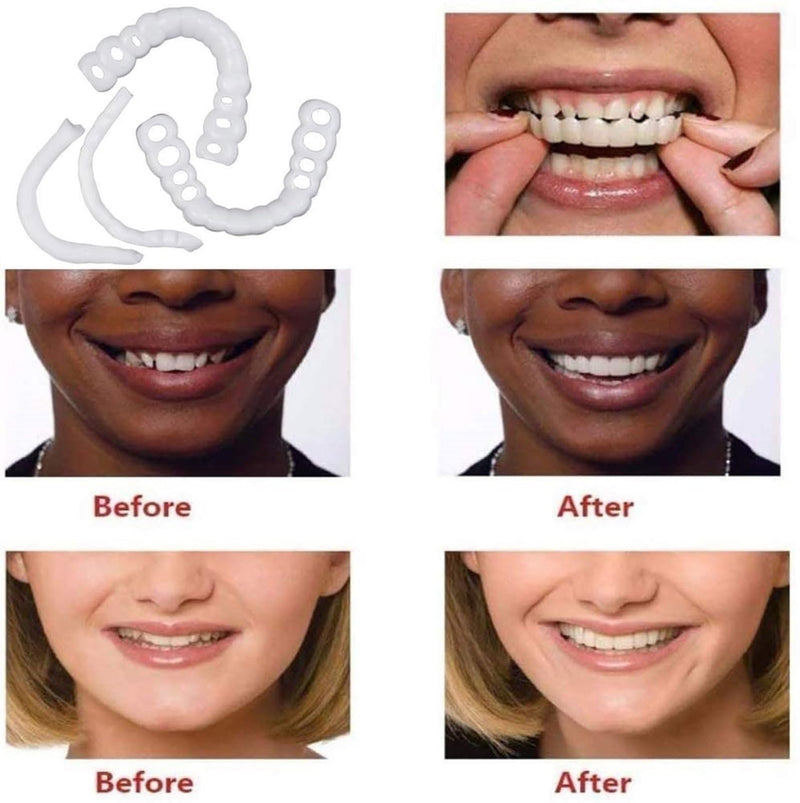 2 Pairs Temporarily Adjustable Top and Bottom, Enhance Your Smile in Just Minutes(White) White