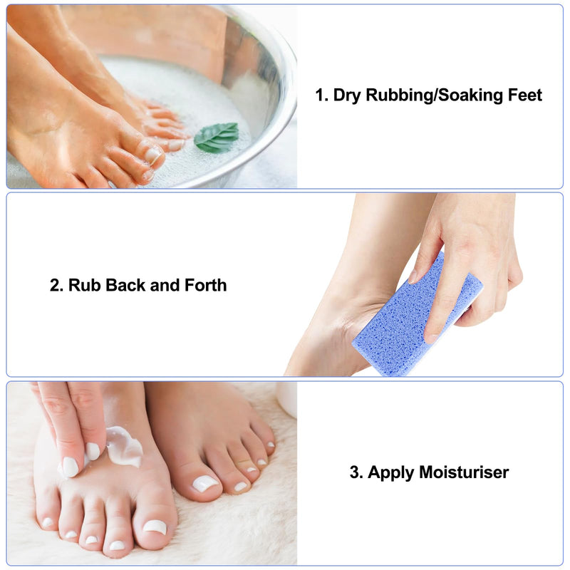 [Australia] - Rseuphiee Pack of 2 double-sided pumice stone feet, pumice stone for feet, foot peeling stone, pumice stone foot care, callus remover, for hard skin on feet and body peeling pedicure tools 