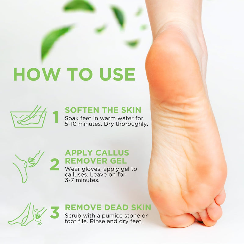 [Australia] - Callus Remover Gel ‚Äì Professional Foot Callus Removal for Smooth Feet & Cracked Heels ‚Äì Extra Strength Callus Gel with Pumice Stone ‚Äì 8oz, Made in USA 