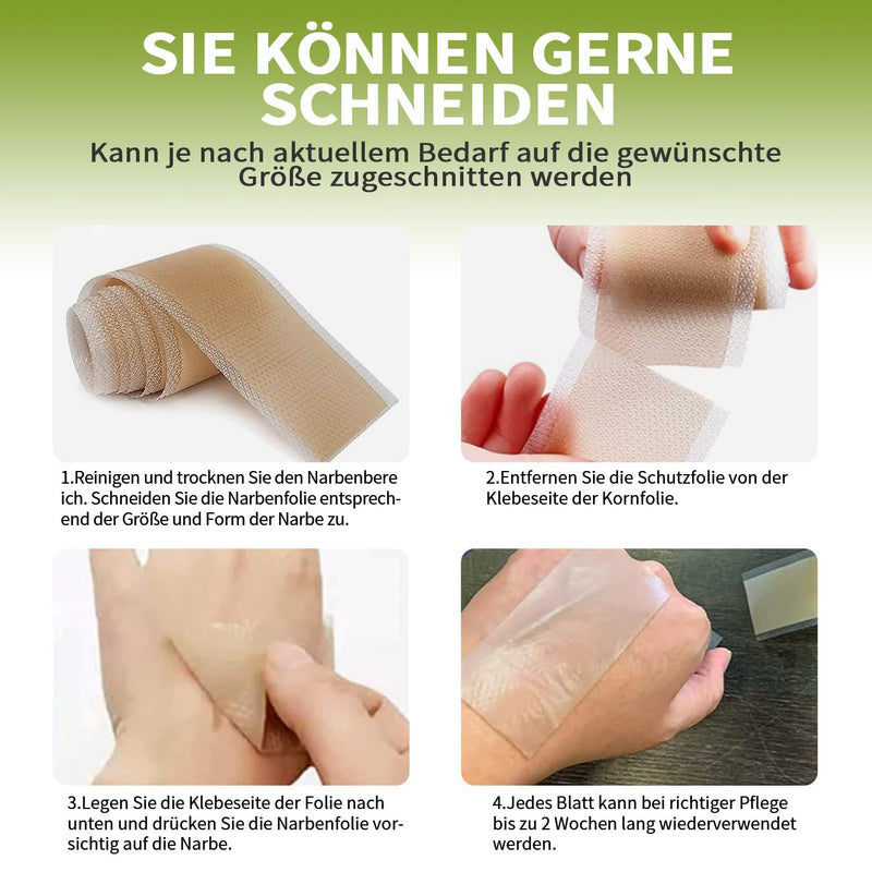 [Australia] - Scar plaster, silicone plaster for scars, silicone scar tape, reusable silicone scar plaster, medical scar treatment for all skin types, safe and effective (4 cm x 150 cm roll) colour 