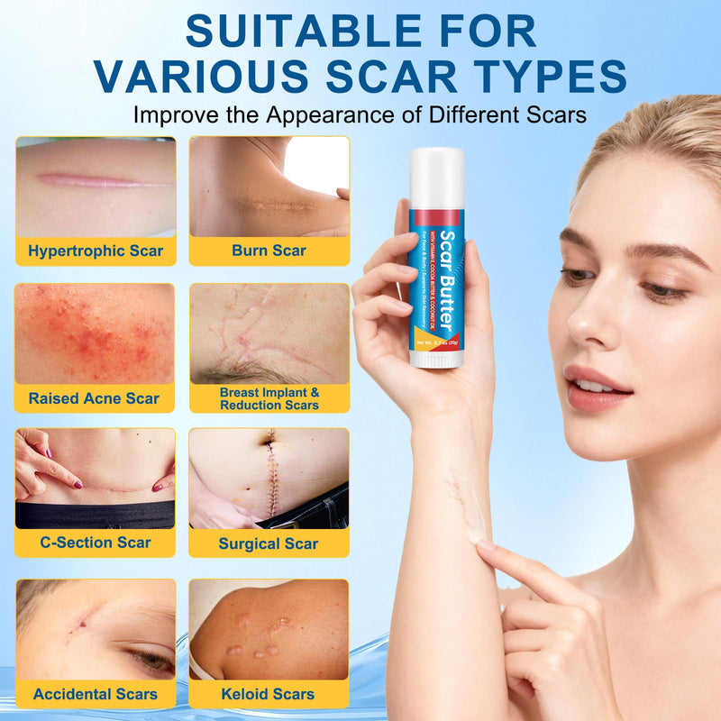 Scar Butter Stick for Scar, 100% Cocoa Butter with Vitamin E & Coconut Oil | Cocoa Butter Sticks Fade Scars, Stretch Marks, for Dry Face, Lip & Body, Non-Greasy, Portable Stick/swivel Applicator 1pc