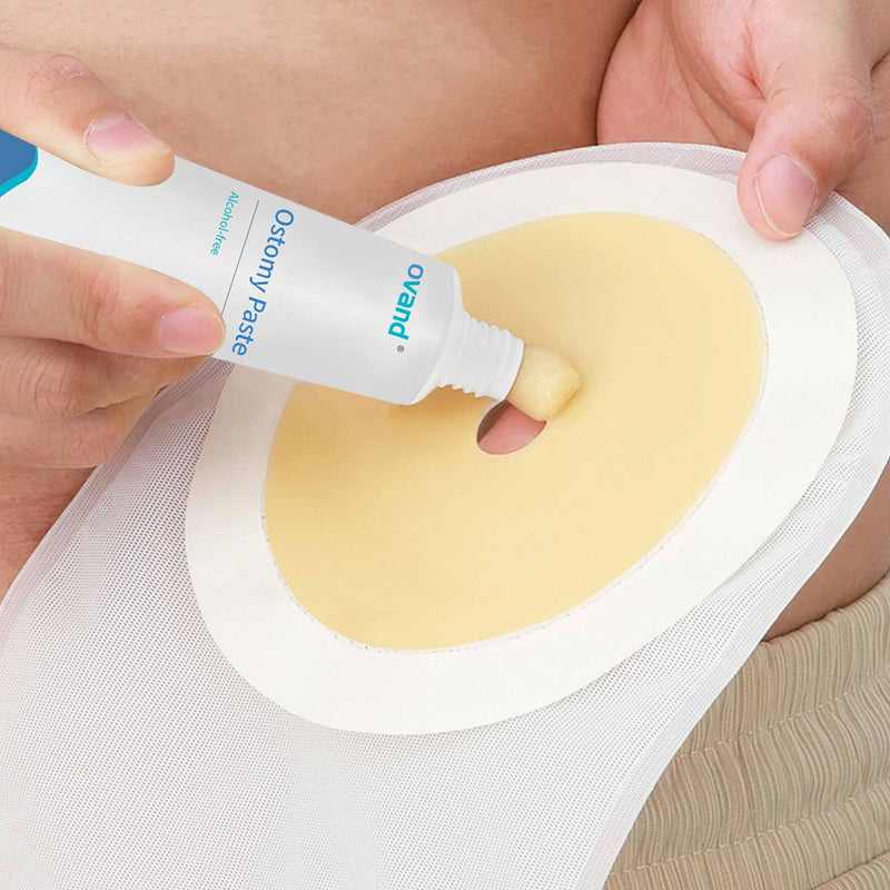 [Australia] - Ostomy Paste, Alcohol-Free Skin Barrier Ostomy Paste, Stoma Care Supplies Osotmy Supplies Accessories,Ostomy Bag Protect Skin Barrier Adhesive & Filler-2.1 Ounce Tube 