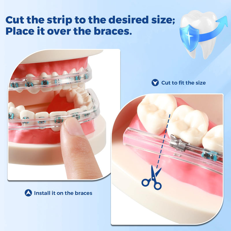 [Australia] - B Rush Comfort Cover for Braces -Orthodontic Lip Bumper, Lip Shield, Mouth Guard for Brackets, Wax Alternative-Dental Lip Protector 