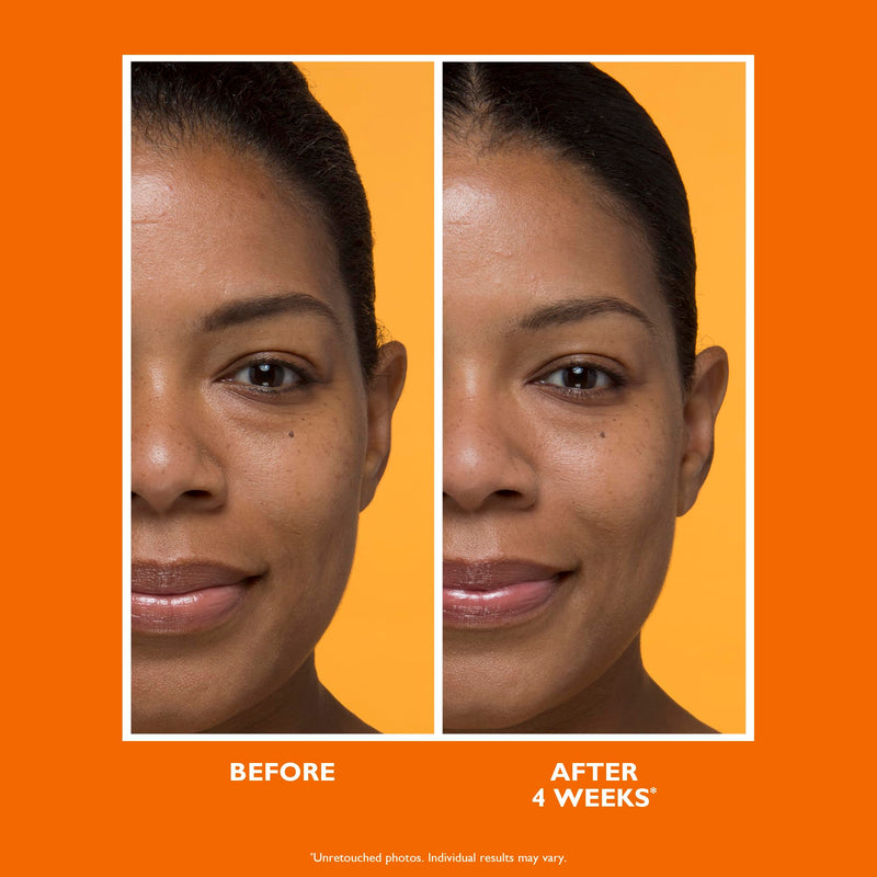 Peter Thomas Roth | Potent-C™ Brightening Vitamin C Moisturizer 1.7 Fl Oz (Pack of 1)