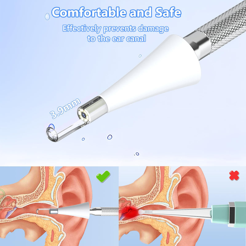 [Australia] - Earwax Remover Otoscope, VITCOCO 3.9mm Otoscope with 4.3 Inch HD IPS Screen, Ultra Thin Ear Cleaner, Ear Cleaner with Camera, White 