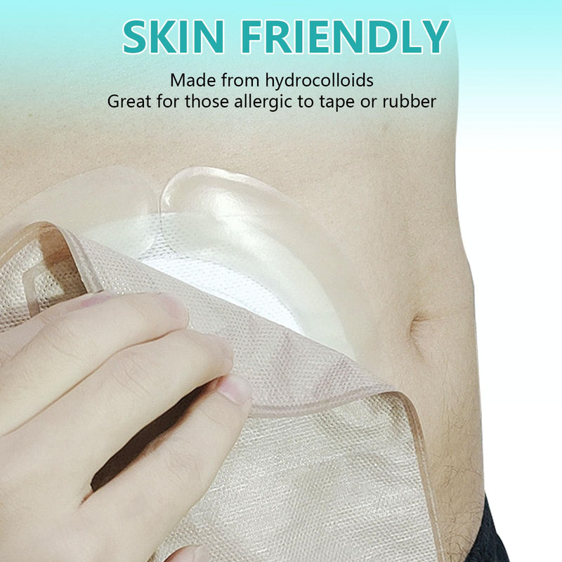 [Australia] - 20 Pcs Elastic Ostomy Barrier Strips, Medical Grade Hydrocolloid Waterproof Leak, Pressure Sensitive Skin Adhesive Tape for Ileostomy Bags, Urostomy Barrier Tape for Colostomy Stoma Bags 