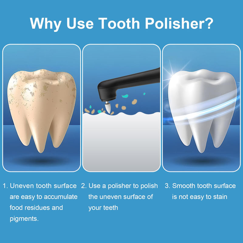 [Australia] - Tooth Polisher - SIQUER Plaque Remover for Teeth Whitening Dental Tools Electric Tartar Polishing Teeth Cleaning Kit with LED Light 5 Speed Modes with 5 Replacement Brush Heads (Black) Black 