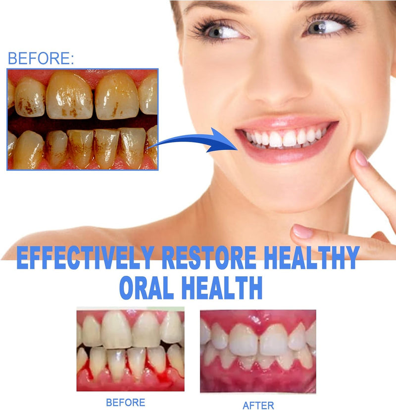 [Australia] - Gum Shield Therapy Gel,Gum Therapy Gel, Gum Repair Treatment Gel, Teeth Whitening Gum Shield, Gum Gel, Teeth Whitening Gel (3-pack) 