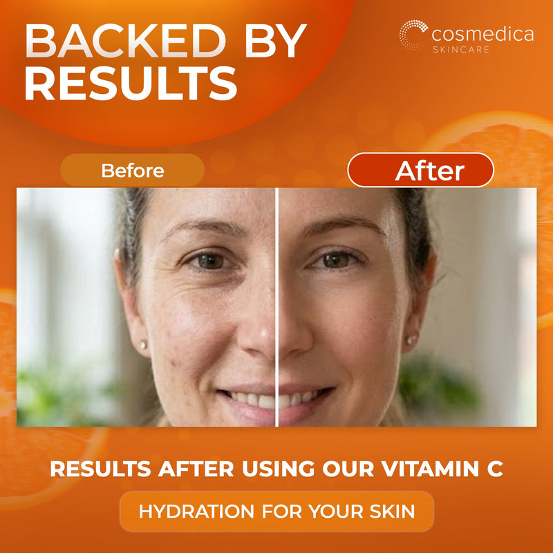 Cosmedica Vitamin C Serum for Face with Hyaluronic Acid & Vitamin E – Brightening Anti-Aging Serum for Dark Spots, Fine Lines & Wrinkles, Lightweight Collagen Booster, 1 fl oz 1 Fl Oz (Pack of 1)