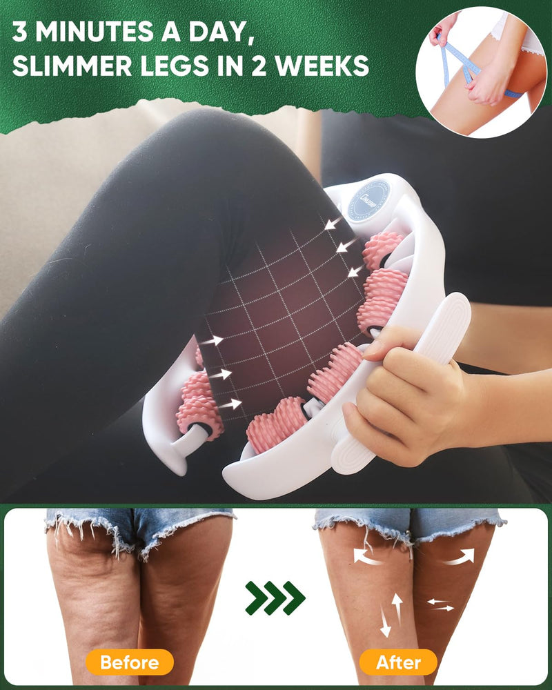 [Australia] - ONUEMP Cellulite Massager Roller, Cellulite Remover Muscle Roller, Fascia Massage Tool for Thigh, Leg, Waist - Anti-Celulitis, Lymphatic Drainage, Body Sculpting, Deep Tissue Pain Relief 
