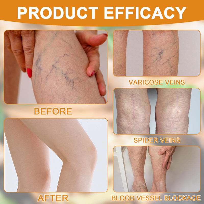 [Australia] - 48 pieces turmeric plaster varicose veins, turmeric varicose vein plaster, Turmeric Max plaster, naturally relieves varicose veins in legs and spider veins, promotes blood circulation 