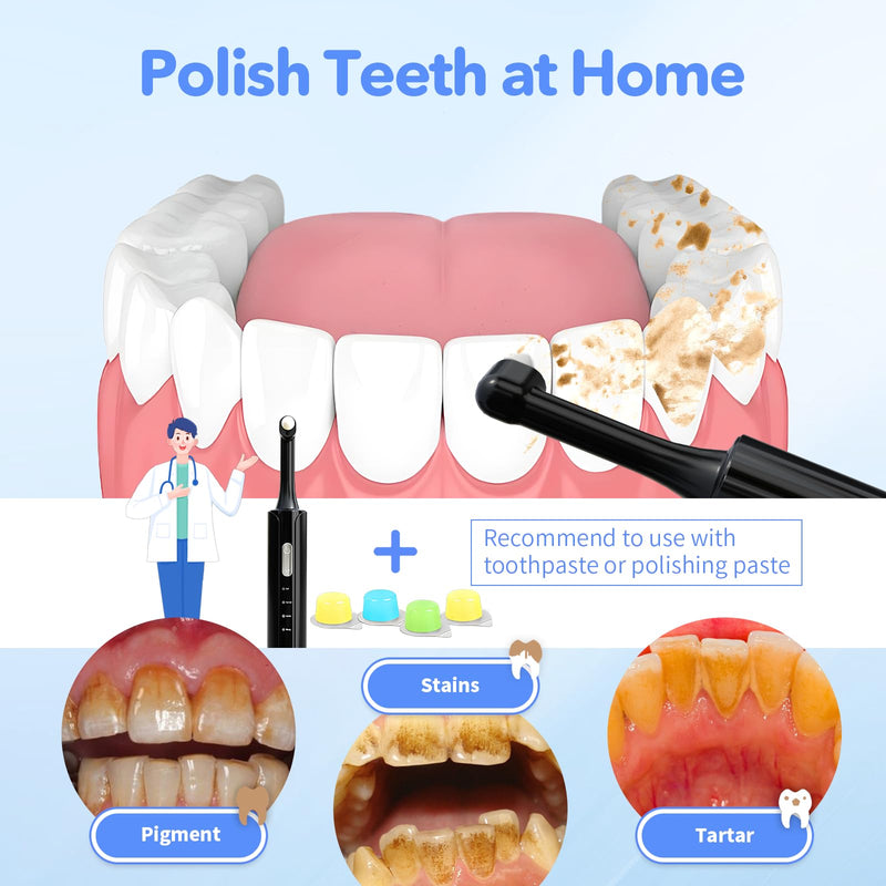 Electric Tooth Polisher,Tooth Polishing Kit for Cleaning and Polishing, Dentist Grade Tooth Polisher with LED Light, Rechargeable Teeth Polisher with 5 Brush Heads, 4 Speed Modes,IPX6 Waterproof