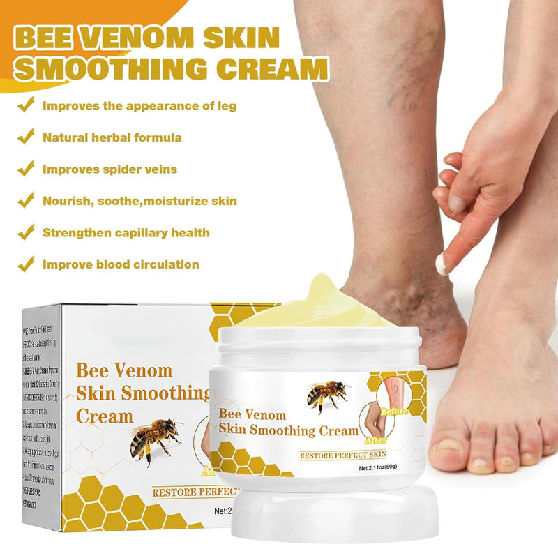 [Australia] - Pack of 2 bee venom varicose veins cream, Furzero varicose veins cream, varicose veins cream, bee venom pain cream, bee venom ointment, for everyone 