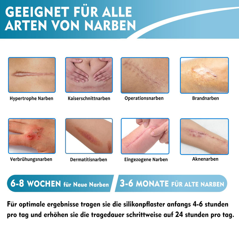 [Australia] - Silicone Scar Plaster, Professional Scar Plaster for C-Section Scars, Surgery, Burns, Keloid, Acne and More, 6-8 Month Supply Silicone Scar Roller (4CMx150CM) 4cmx150cm 