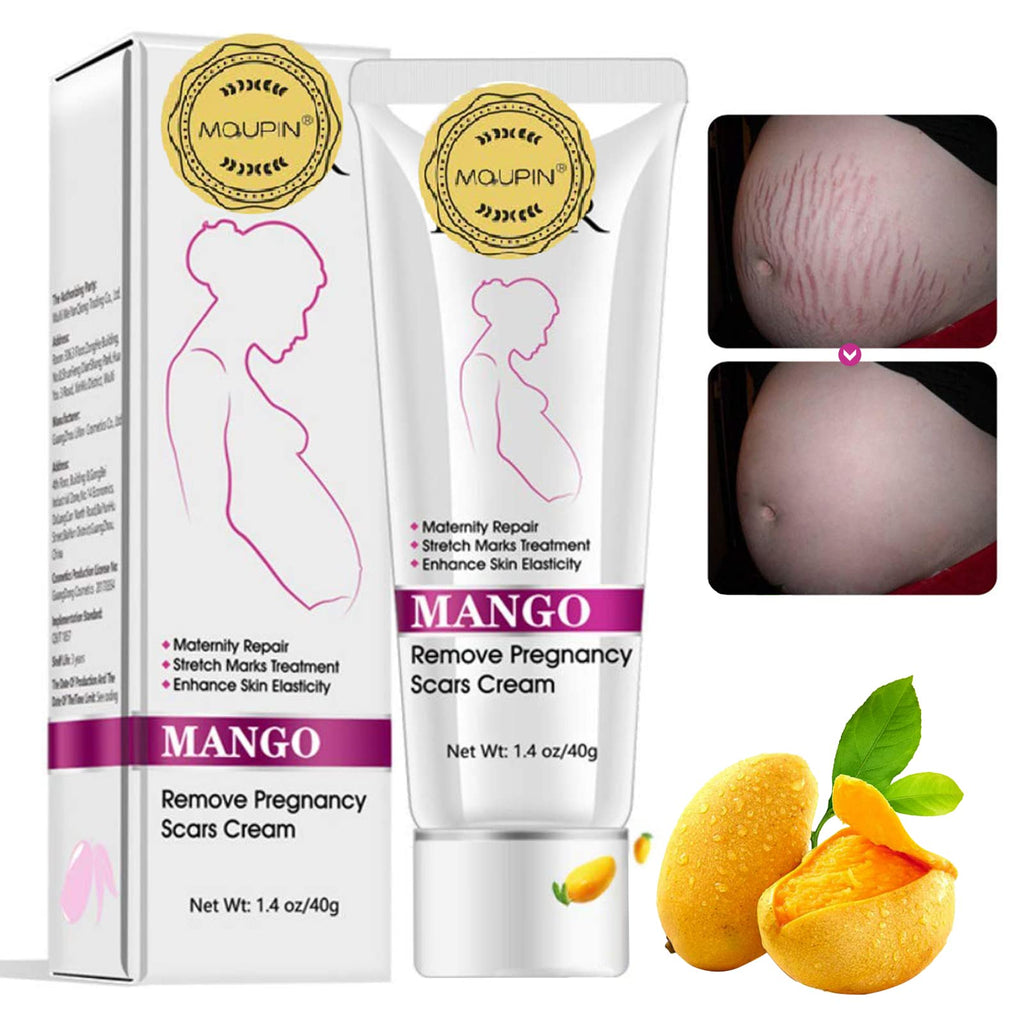 RtopR Mango Stretch Marks and Scar Cream -Stretch Marks and Scar Removal Cream for Pregnancy - Best Body Moisturizer-40g 1.41 Ounce (Pack of 1)