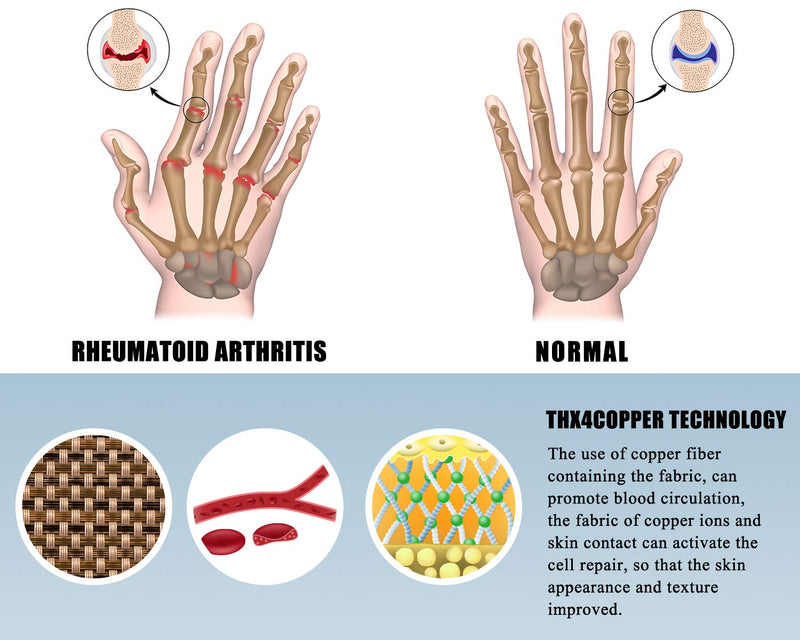 [Australia] - THX4COPPER Infused Compression Arthritis Glove,Carpal Tunnel, Typing, Support Medium (Pack of 1) 