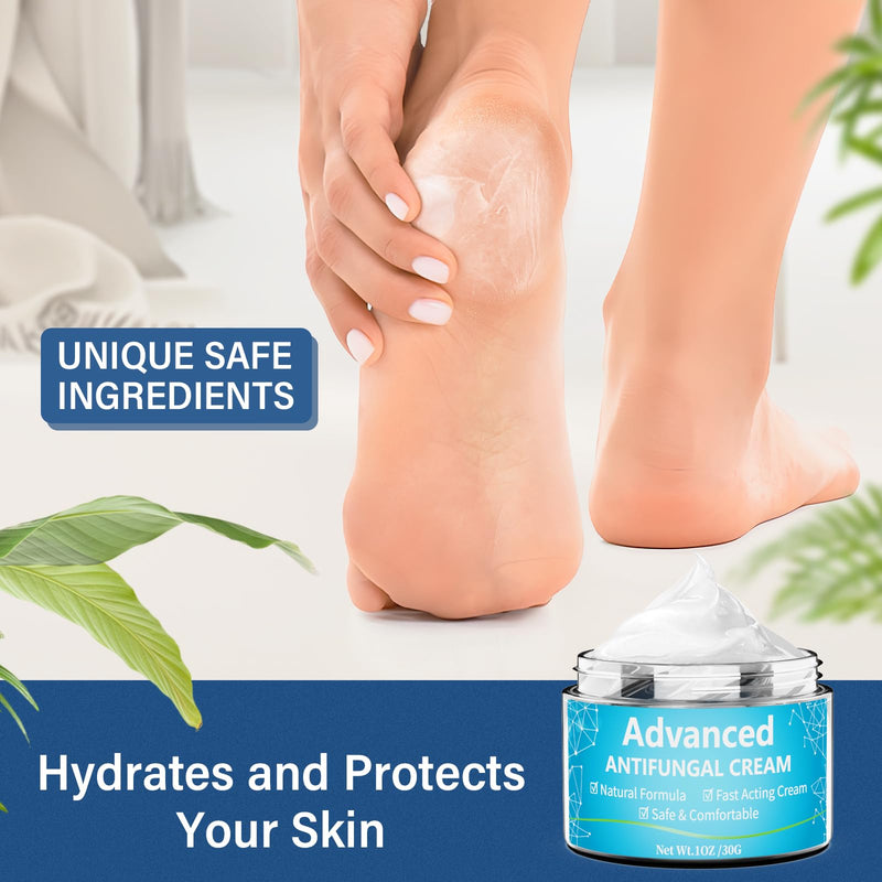 [Australia] - Skin fungus cream, athlete's foot cream with tea tree oil and herbal extracts, Expertcare fungicide for the treatment of athlete's foot and psoriasis - against itching, soothes, inflamed & dry skin 30 ml 