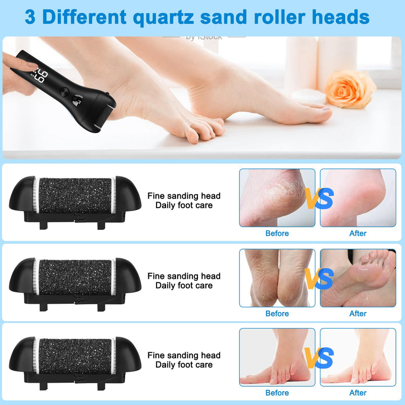 [Australia] - UCAMP electric callus remover with 3 replacement rollers, electric callus remover, waterproof callus rasp, callus removal foot, rechargeable, foot callus remover for foot care 
