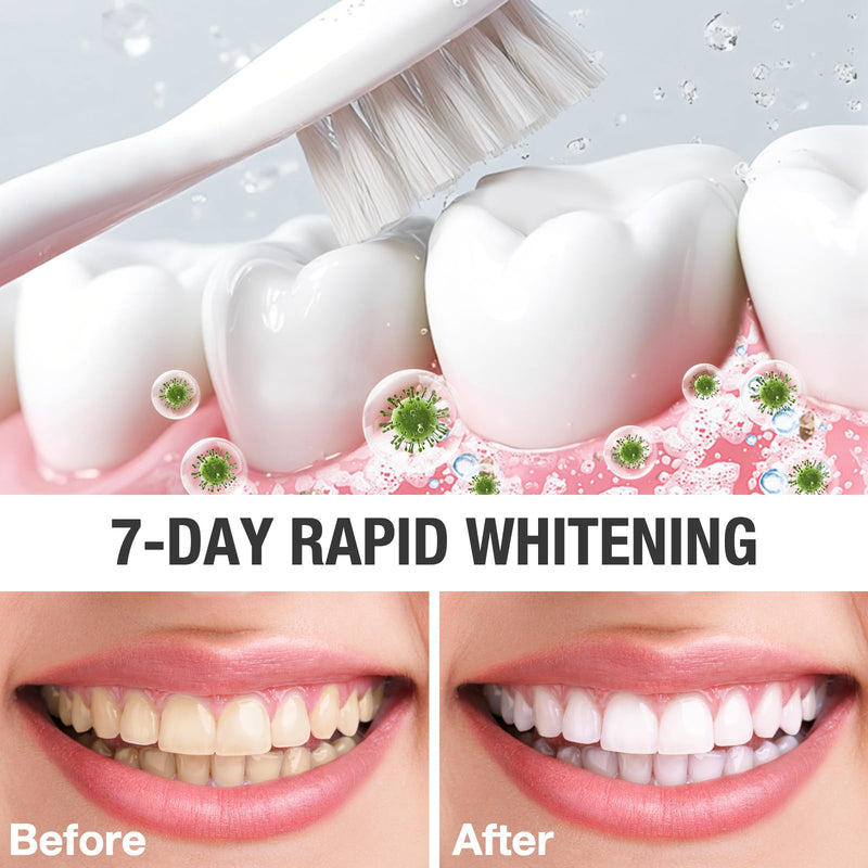 [Australia] - 2PCS Nano Hydroxyapatite Toothpaste for Advanced Enamel Protection and Tooth Strengthening, Gentle and Effective Formula, Gentle Mint, Fresh Breath, Reduce Tooth Sensitivity 2 