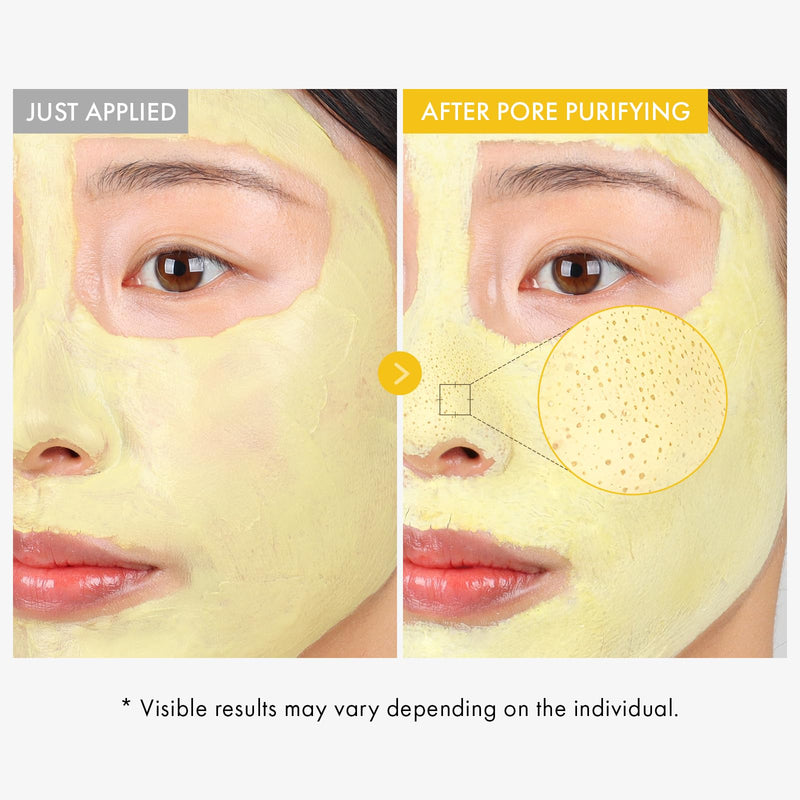 TOSOWOONG Kojic Acid Turmeric Mud Mask for Dark Spots & Pore Care, Freckles | 25% (246,019ppm) Kaolin + 5.4% (54,000ppm) Bentonite, Vitamin C, Niacinamide, Arbutin, Blackheads, Korean Skincare, 3.52 oz