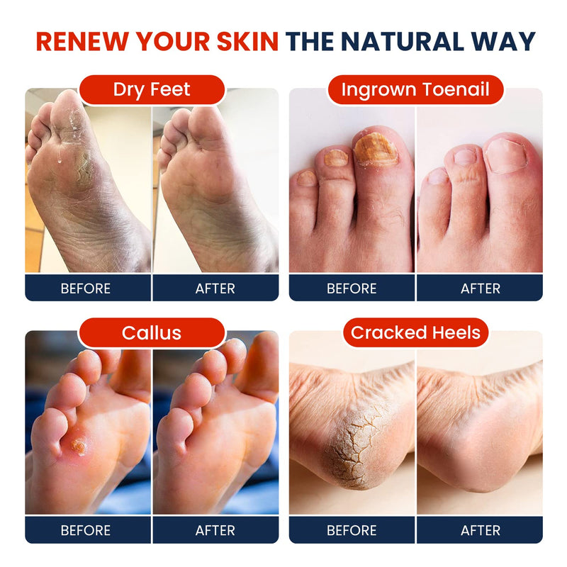 [Australia] - Muscle Relief Foot Soak with Epsom Salts - All Natural Salts for Post Workout - Easy Way to Remove Hard Calluses & Dead Skin Build-Up - Professional at Home Foot Care for Men & Women - Made in The USA 