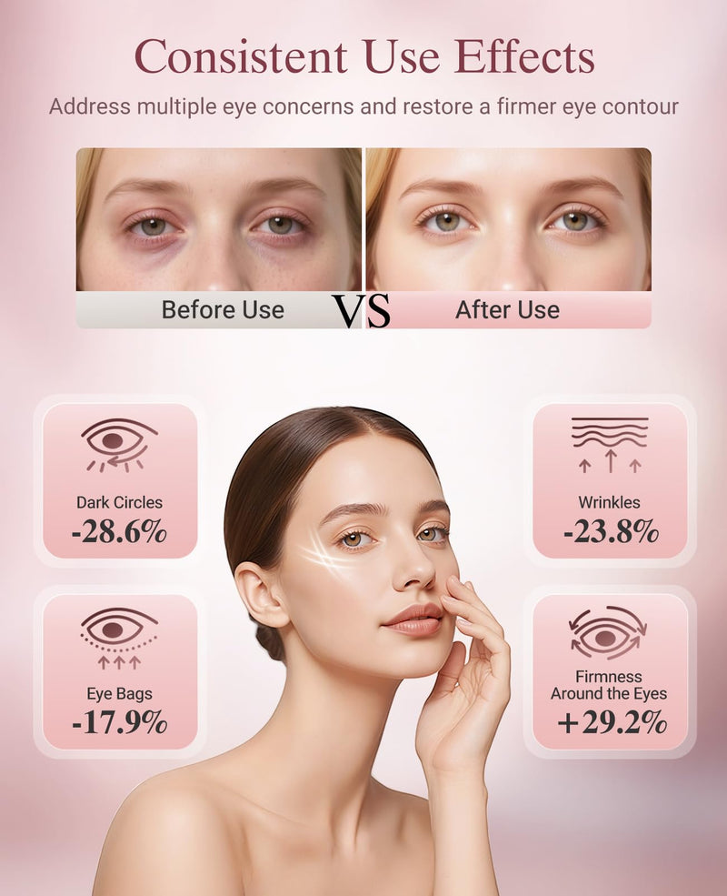 Red Light Therapy for Eyes, Wireless Under-Eye Red Light Therapy Mask with Timing Function, 3 Modes for Eyes Bags, Dark Circles, Fine Lines, Rechargeable Home Skincare Eye Mask