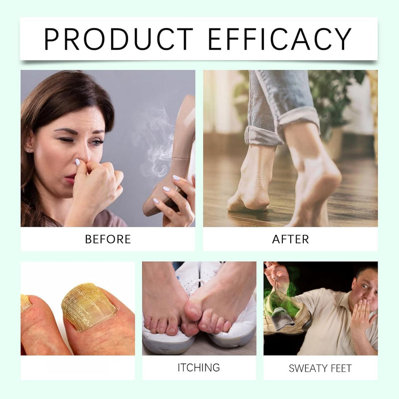 2PCS Foot Sanitizer Spray with Tea Tree Oil,Clear Foot Sanitizer Spray,Tea Tree Oil, 100 ml/3.5 oz