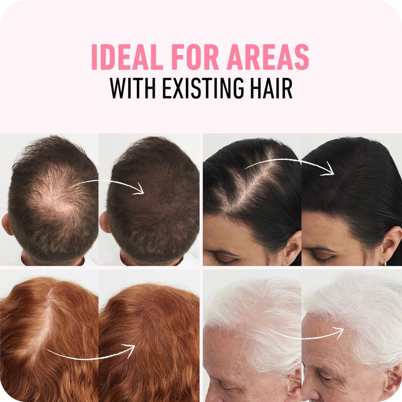 BOLDIFY Hair Fibers for Thinning Hair, for Women & Men, Dark Brown 28g | Instantly Fills Thinning & Fine Hair for a Fuller, Thicker Look - Thin Spot Cover Up - Hair Building Fibers & Hair Powder