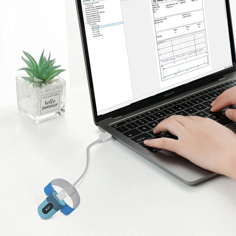 [Australia] - Original D-Type USB Charge Data Cable for Checkme O2 Max, SleepU, VisualOxy, Oxiband Ring Pulse Oximeter, BabyO2, BabyO2 S2 