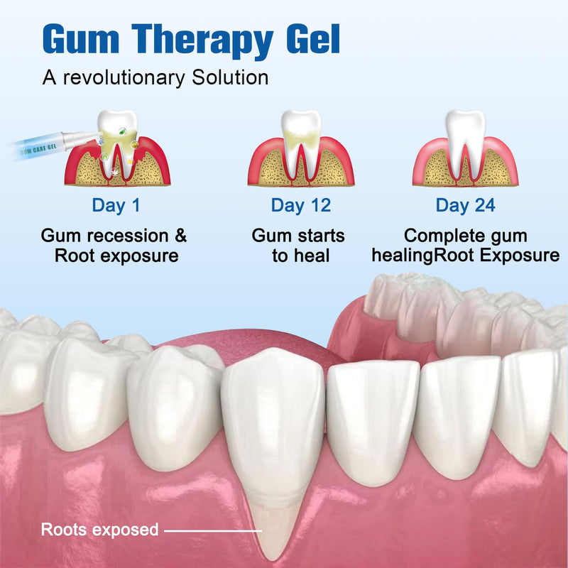 [Australia] - Taileden™ Gum Repair Therapy Gel, Gum Therapy Gel for Recessed Gums, Neslemy Gum Shield Therapy Gel, Teeth Whitening Gel Instant Soothing Gel, Instant Gel Pen for Oral Care(3pcs) 