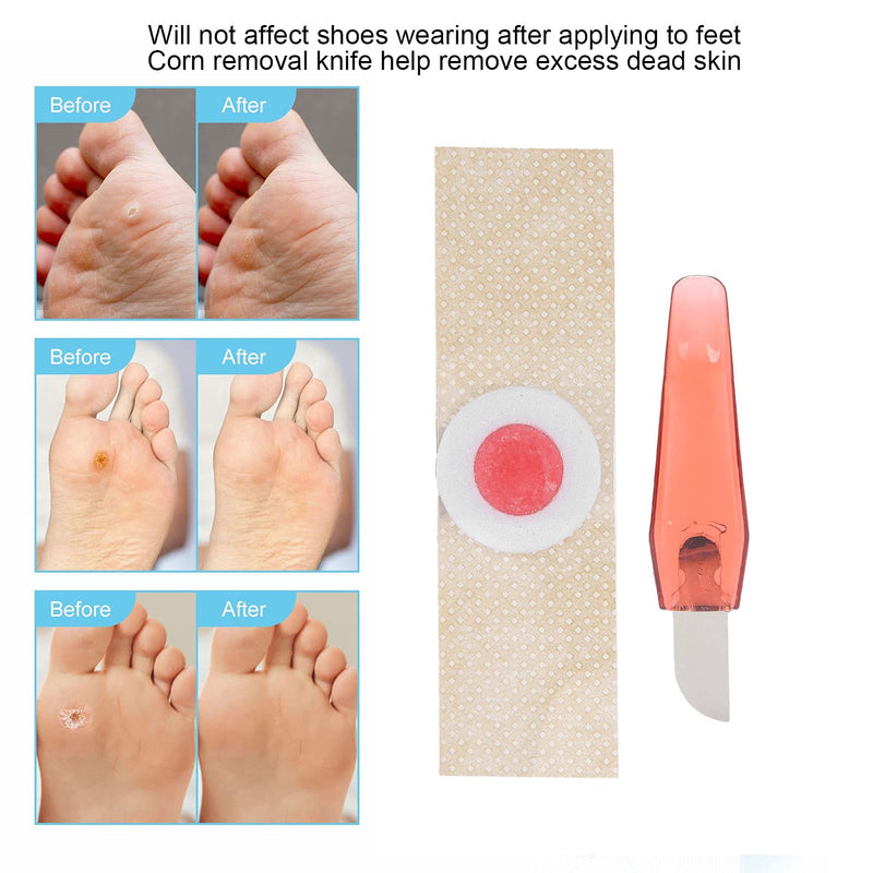 [Australia] - Corn Plasters, Removing Corns Quickly, Safely and Effectively to Use Foot Corn Remover Pads Toes Horn Hollow Skin Remover, Protection Against Shoe Pressure and Friction for All-Day Use 