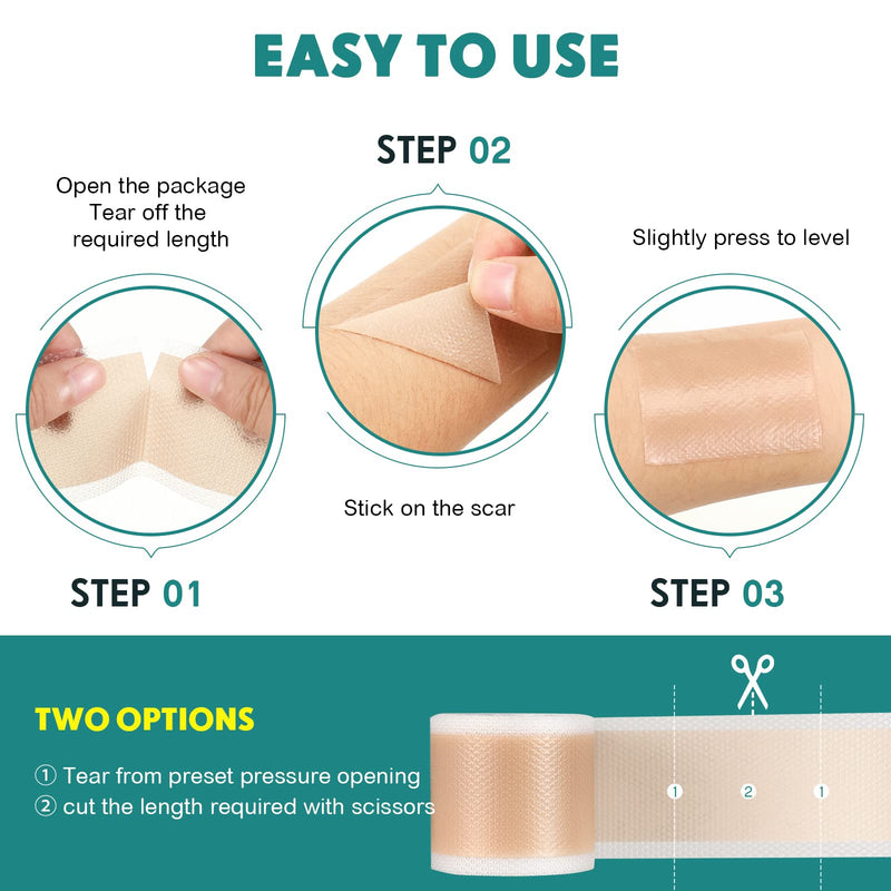 [Australia] - Silicone Scar Sheets, Silicone Scar Tape(1.6” x 120” Roll-3M), Scar Removal Away Strips for Surgical Scars, Keloid, C-Section, Burn et 120x1.6 Inch (Pack of 1) 