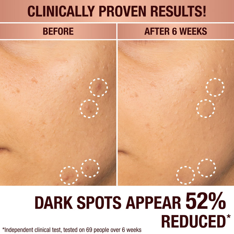 Charlotte Tilbury Radiance Recovery Dark Spot Serum - Tranexamic Acid & Vitamin C Serum for Brighter Looking Under Eyes, Redness, Uneven Skin Tone - Treatment to Reduce Appearance of Aging Skin 0.34 Ounce (Pack of 1)