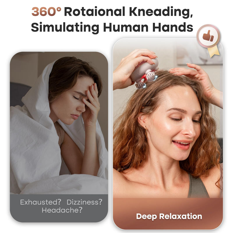 arboleaf Scalp Massager Kneading Head Massager Scalp Stress Relax Portable Rechargeable Hair Massager Shower Massage Waterproof Cat Massager Scratcher,Gift for Mom Dad | 128 massage nodes, 8 removable claws, cat scratcher, gift for Mom Dad Rose Pink