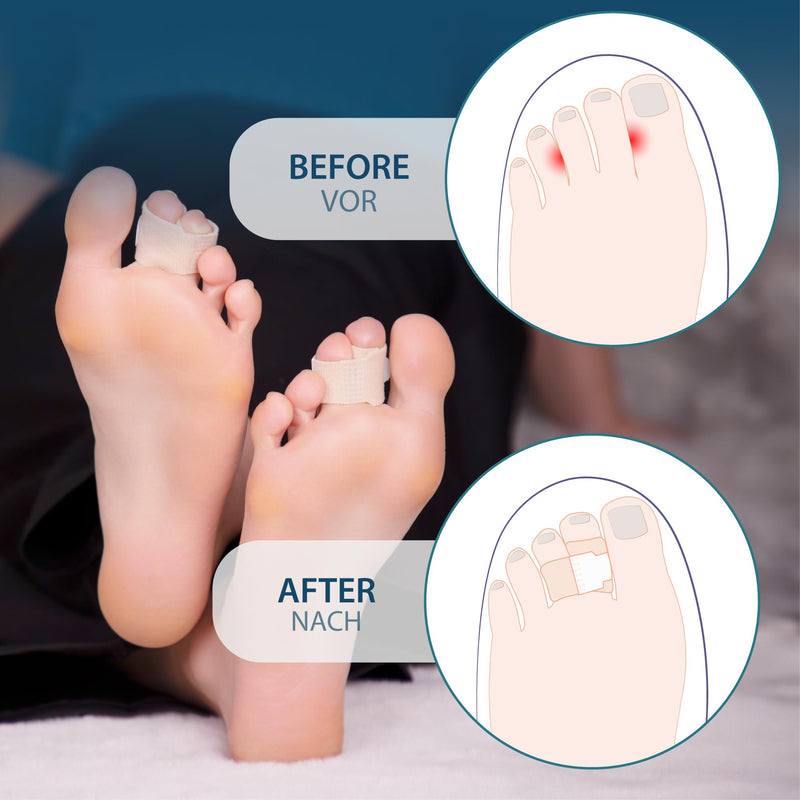 [Australia] - HALUTO 10 pieces hammer toe correction toe bandage - hammer toe correction toe stretcher, splint toes, fingers, callus toes, hammer toe pads, hallux band, toe splint 10 pieces 