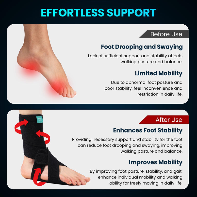 Welnove Foot Drop Support Brace, AFO Ankle Stabilizer for Improved Walking, Aiding Foot Control in Cases of Drop Foot, Nerve Injuries, Spinal Conditions, and More (Right)