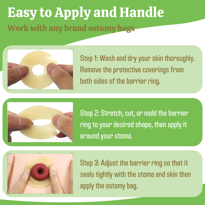 [Australia] - Elastic Moldable Ostomy Barrier Rings- Outer Diameter 2" (48mm) 4mm Thickness -Ostomy Supplies Non-Leaking Seal for Stoma, Sting-Free Hydrocolloid Skin Barrier Extender Ring for Colostomy Bags, 10PCS 10 Count (Pack of 1) 