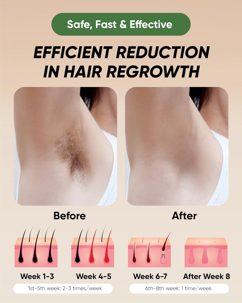 [Australia] - XSOUL At-Home IPL Hair Removal for Women and Men Permanent Hair Removal 999,999 Flashes Painless Hair Remover on Armpits Back Legs Arms Face Bikini Line, Corded White 
