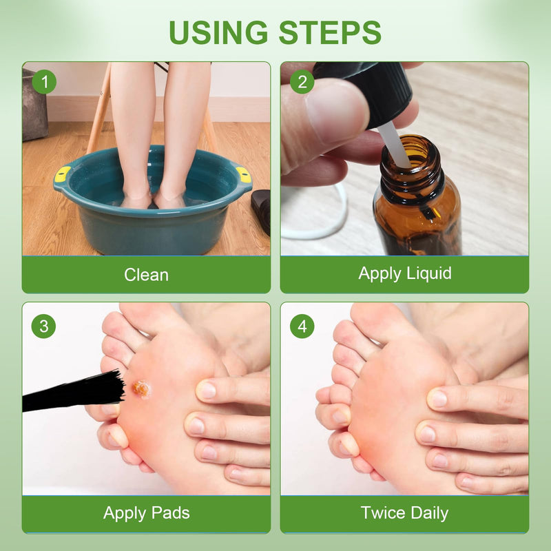 [Australia] - MQFORU Corn Remover, Corn Removers for Toes, Callus Remover for Fast-Acting Foot Care - Plantar and Common Callus Remover 15ML (0.51 oz 15 pcs Pads) 