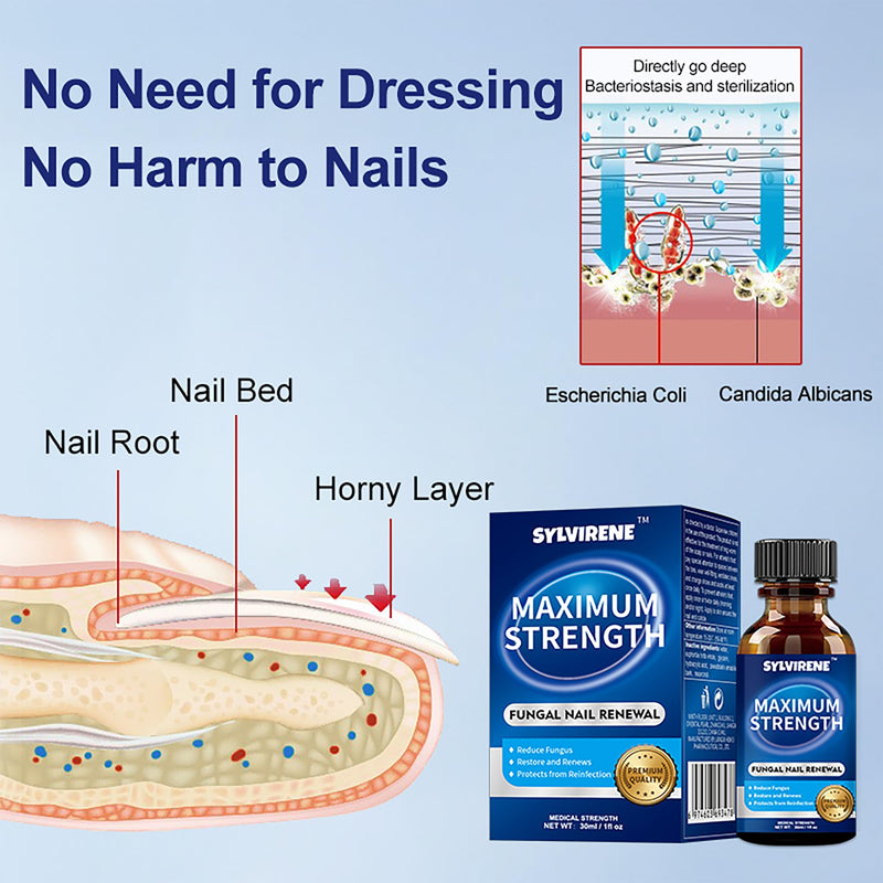 Extra Strength Toenail Fungus Treatment 1oz, Restore Yellow Nails | For Toenails & Fingernails, Gentle Non-Irritating, Precision Brush Applicator, Fast-Absorbing, Athlete's Foot Relief