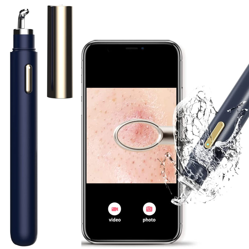 Blackhead Remover with Camera, WiFi Visual Blackhead Remover Tools with White/Blue Lights for iPhone, Android Phones Women Gift Blackhead Remover - Navy Blue