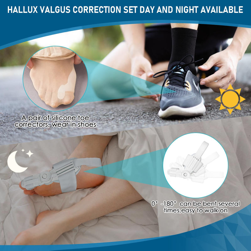 [Australia] - Baby Molove Hallux Valgus Correction, Adjustable Button Hallux Valgus Splint Bunion, Elastic Bunion Corrector, Hallux Valgus Bunion Correction White 