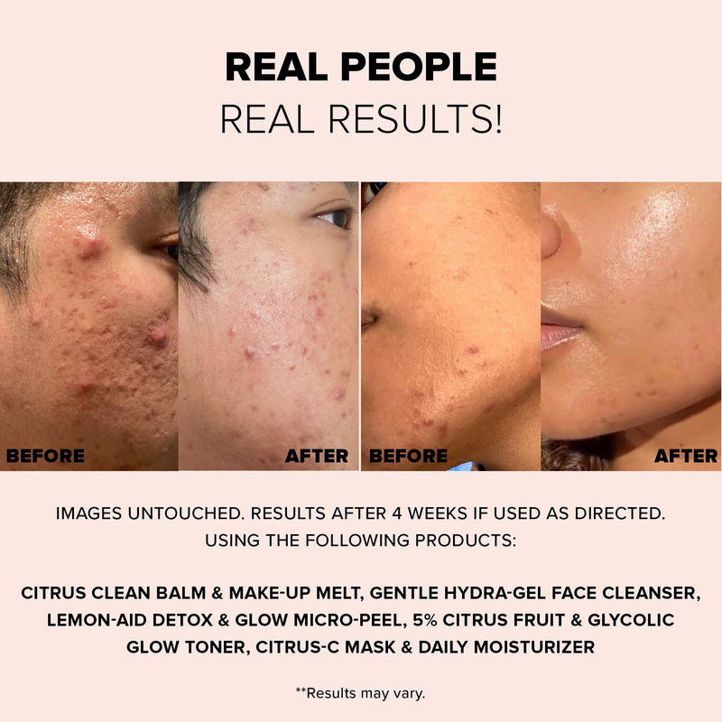 Nudestix Citrus-C Mask & Daily Moisturizer – 2-in-1 Hydrating Vitamin C Cream with Yuzu & Turmeric | Clean Beauty, Brightening Face Moisturizer for Glowing Skin | Vegan & Cruelty-Free