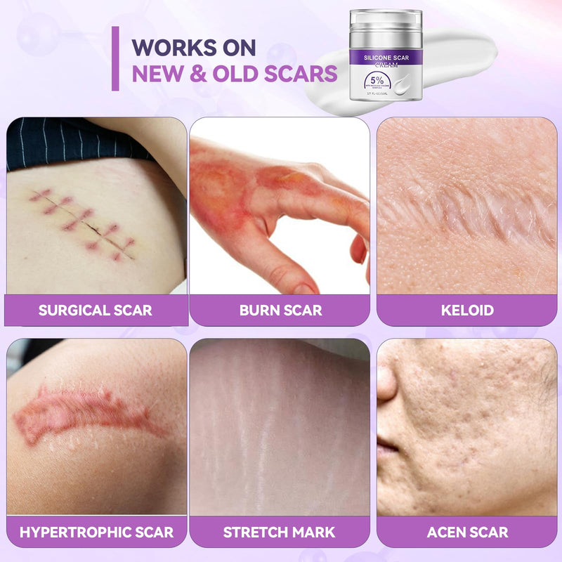 [Australia] - Advanced Scar Cream, Silicone Scar Gel for Old and New Scars, Scar Removal Cream for Surgical Scars, Stretch Marks, C-Section, Keloids, Injury, Acne, and More 1.7 oz(50ml) 
