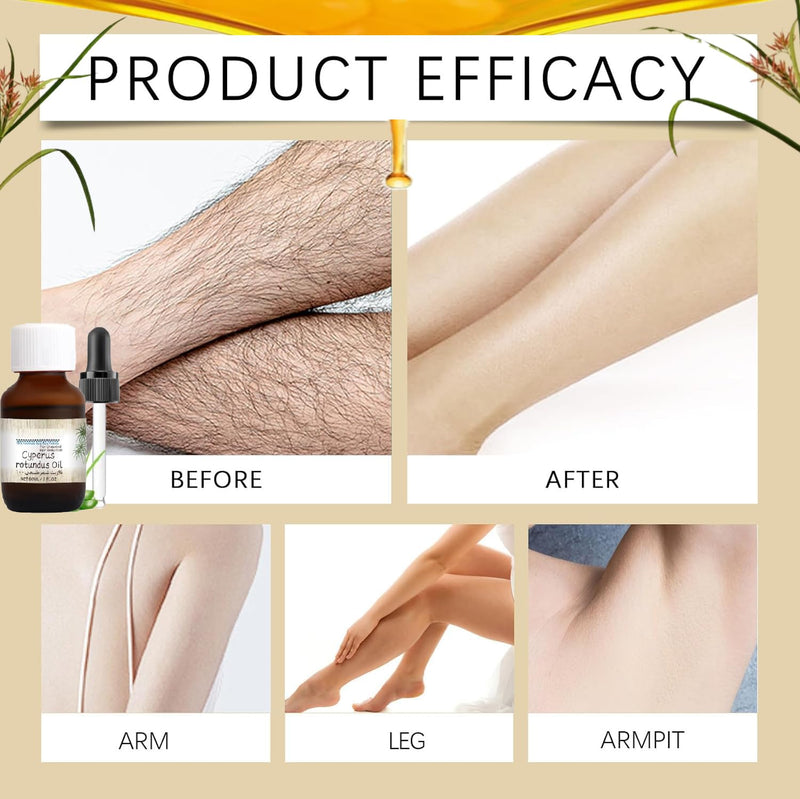 [Australia] - Cyperus rotundus oil,Pure Cyperus Oil Silky Hair Remover,Cyperus essential oils for hair removal,Mature Cyperus rotundus oil for reducing body hair growth 