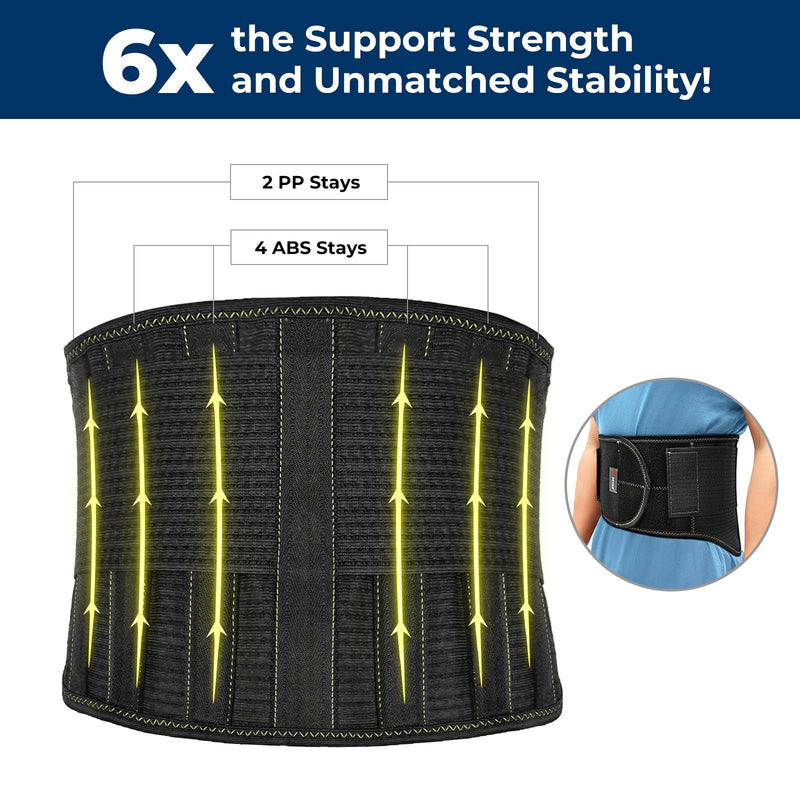 [Australia] - ZOYER Back Brace for Men Lower Back for Pain Relief of Lumbar/Waist, Back Support Belt with Lumbar Splints for Herniated Disc, Sciatica, Scoliosis X-Large 