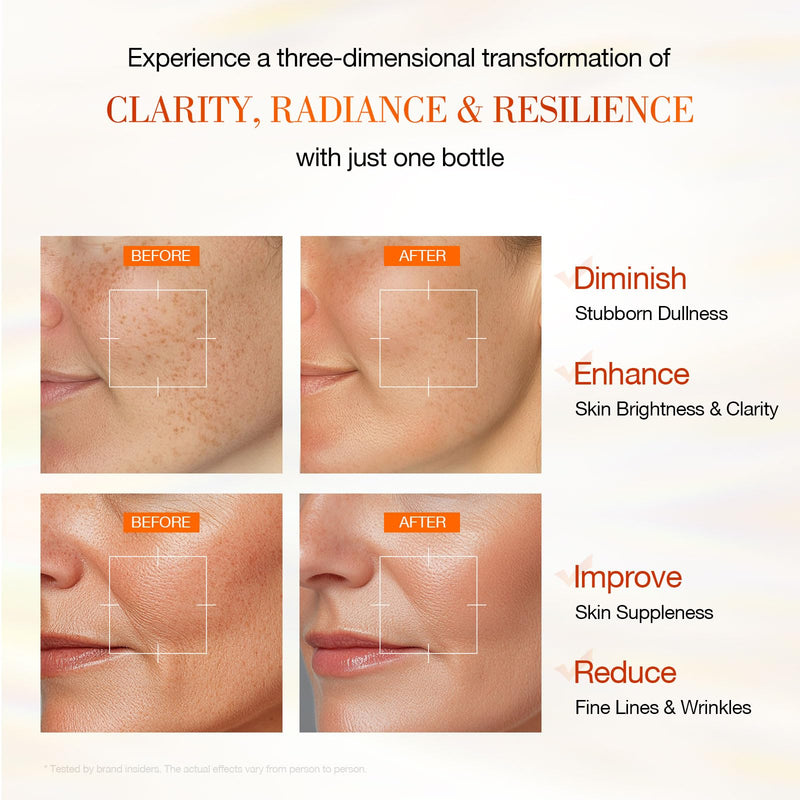 NEUTRIHERBS 20% Vitamin C Serum, Antioxidant Even Skin Tone-0.77 Fl Oz | Brighten & Anti-Aging & Boost Collagen, Revive Glow Dullness Uneven Skin, Nature Lightweight Skincare for Women and Men