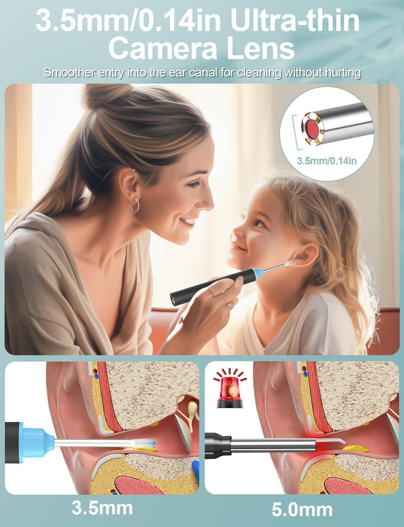 [Australia] - VIYSPNV Otoscope 3.5mm WIFI Wireless Digital Camera with 6 LED Lights 1920P HD Ear Endoscope Compatible with iOS and Android for Children Adults and Pets 