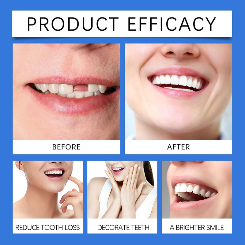 [Australia] - Soft Silicone Denture Liners – Comfortable Fit Denture Set with Upper & Lower Lightweight Liners for Secure Fit & Comfortable Wear (1 Set) style-1 